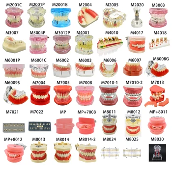 SEUJJRO Различные Типы Зубных Моделей Съемные Зубные Имплантаты Ортодонтическое Обучение Демонстрация Для Школы Студентов-Стоматологов
